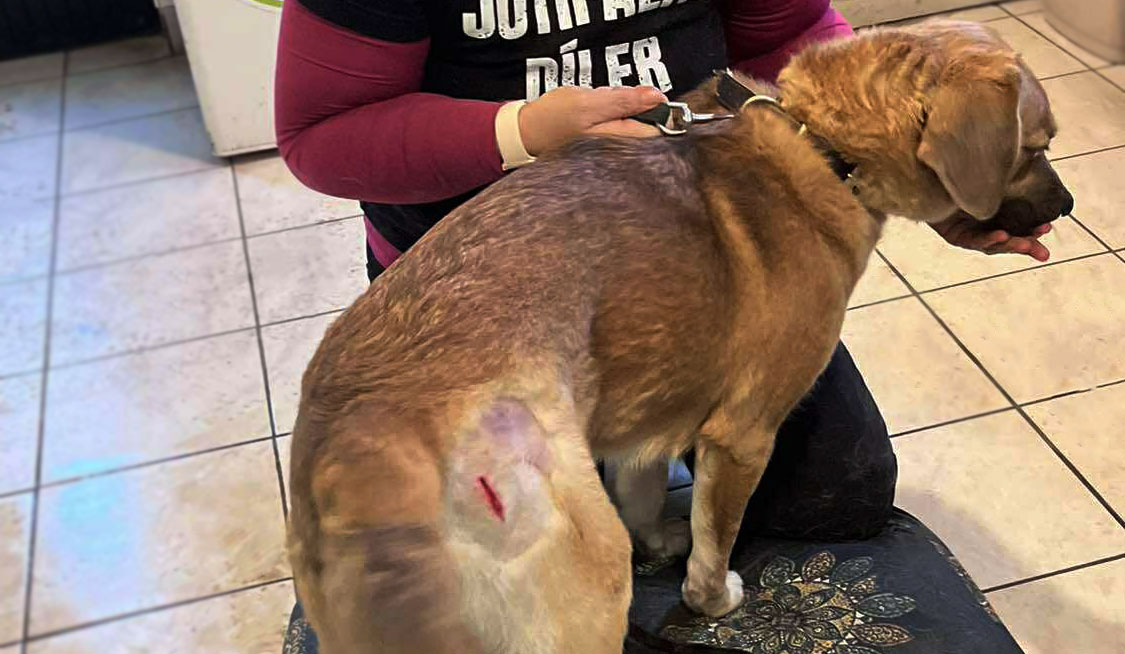 Laser Treatment After a Car Accident